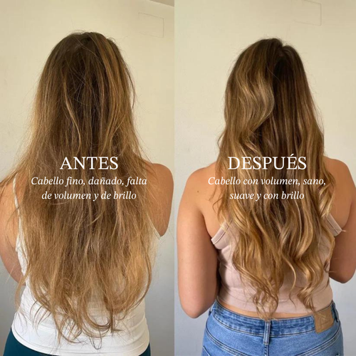 Hair Density Treatment